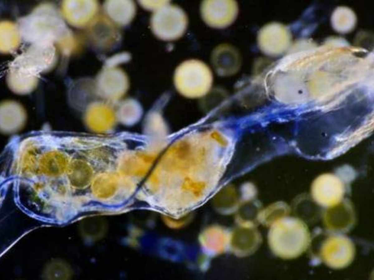 Plastic fibres from synthetic clothing are ending up in our food chain. Here's how to stop it happening.
